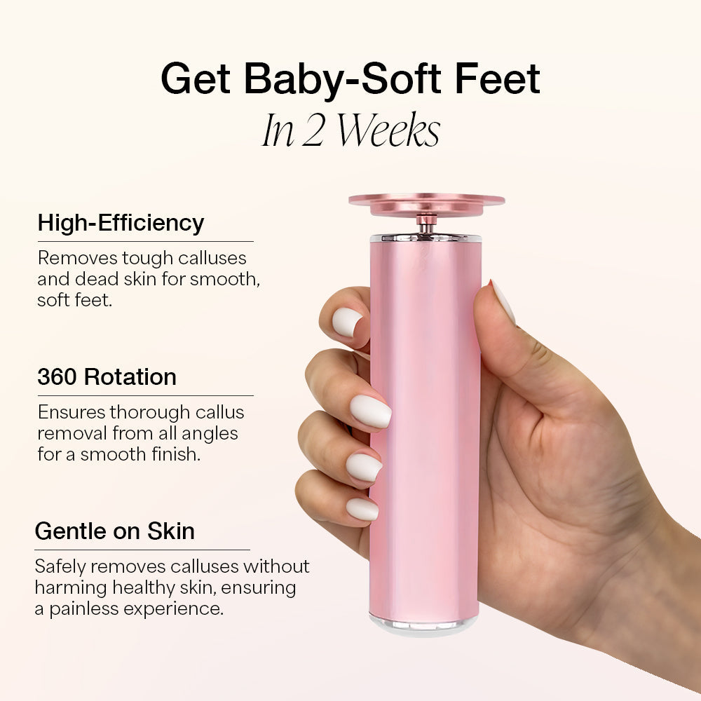 Auranex Electric Foot Callus Remover